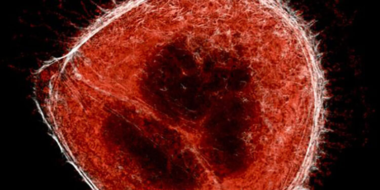 EN LATINOAMÉRICA DETECTAN NUEVA VARIANTE DE SARS COV 2; SE LLAMA “LAMBDA”