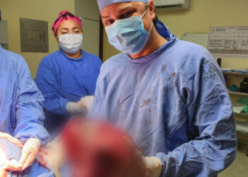 ESPECIALISTAS DEL IMSS EXTIRPAN TUMOR MALIGNO DE 13 KILOS A PACIENTE DE VERACRUZ