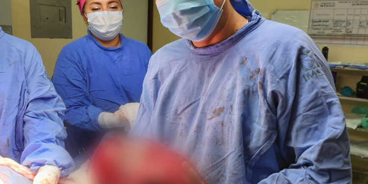ESPECIALISTAS DEL IMSS EXTIRPAN TUMOR MALIGNO DE 13 KILOS A PACIENTE DE VERACRUZ